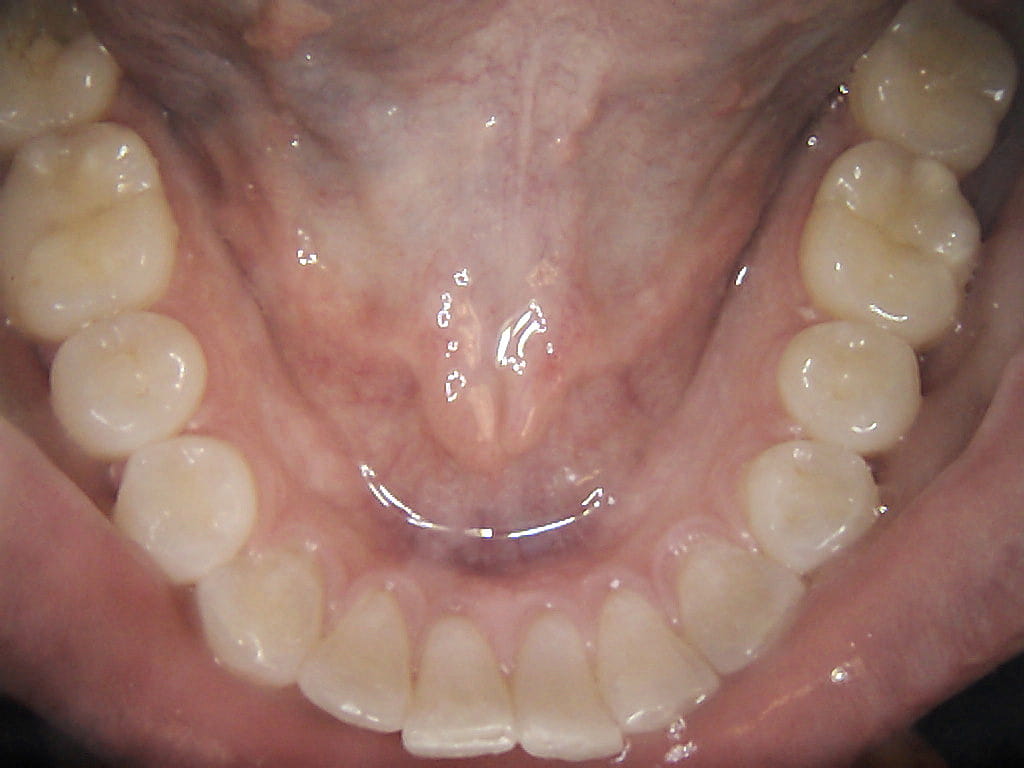 Klinisk billede taget med CS 1500 — tandbueoverblik med RGB